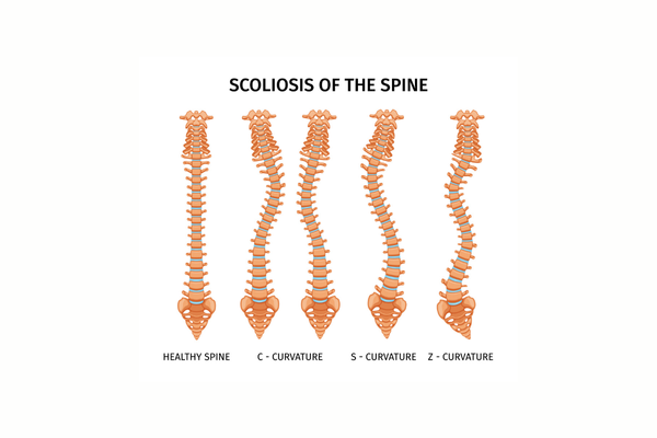 Omurga Değerlendirmesi